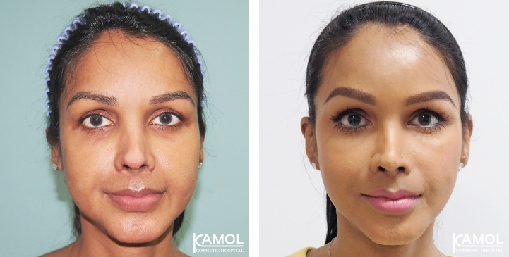 lg-6494958f8d631-image