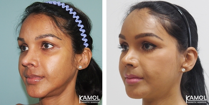 lg-6494958f8f517-image