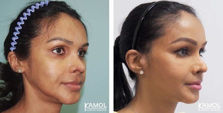 lg-6494958f9342f-image