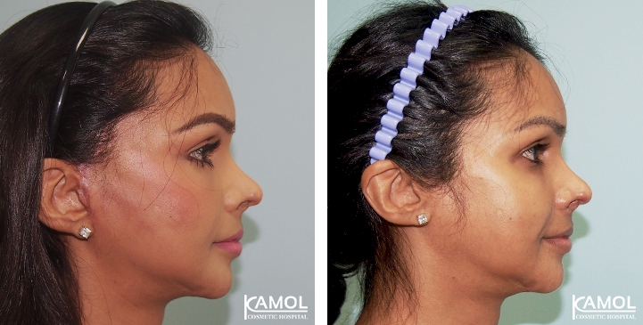 lg-6494958f95476-image