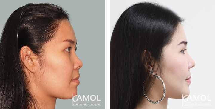 lg-6494958fc5533-image