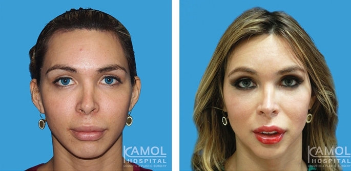 lg-6494958fc83c7-image