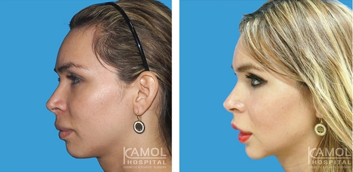 lg-6494958fca95c-image