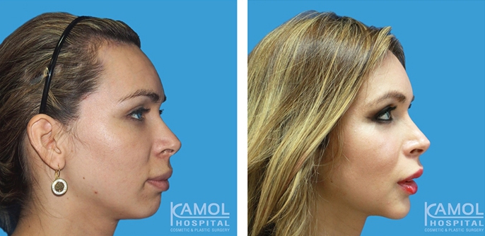 lg-6494958fcc842-image