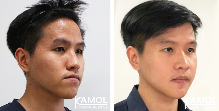 lg-6494958fe102f-image