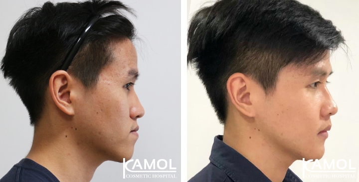 lg-6494958fe2fdd-image