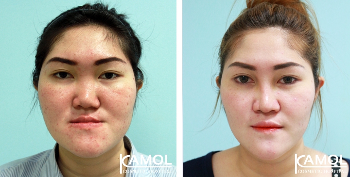 lg-6494958fe5d86-image