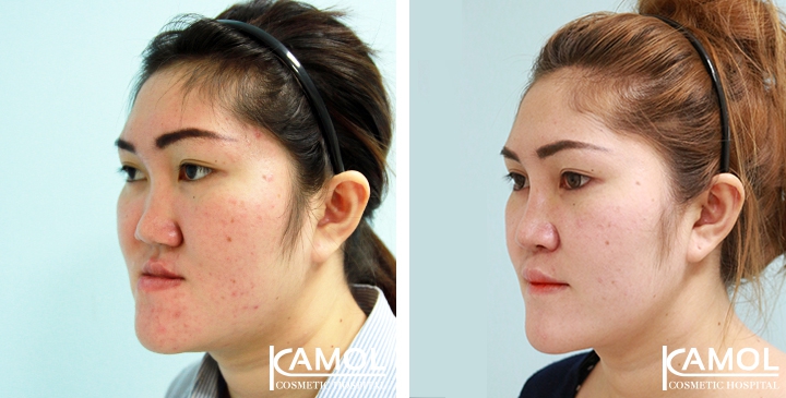 lg-6494958fe7eb1-image