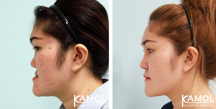 lg-6494958fe9f19-image