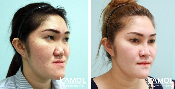 lg-6494958febed1-image