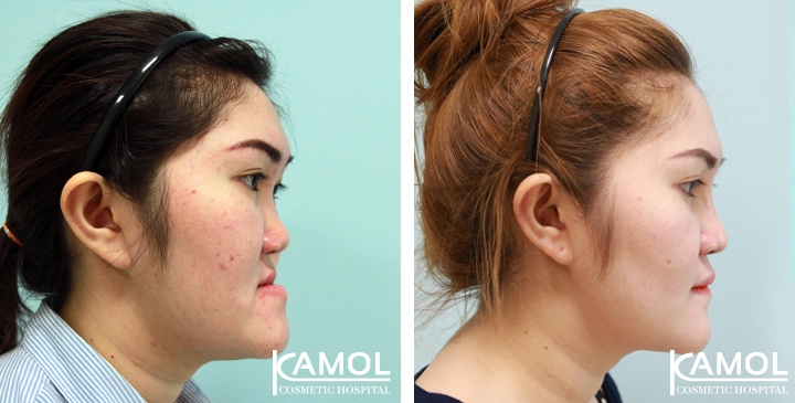 lg-6494958fee194-image