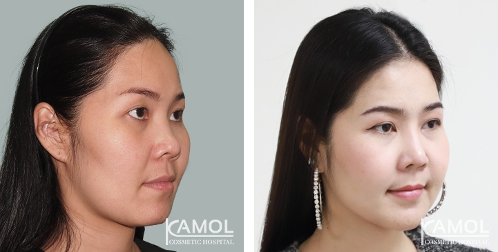 lg-6494959024350-image