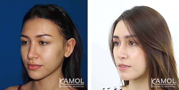 lg-6494959436e8c-image