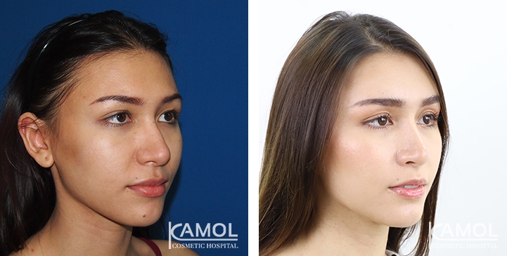 lg-649495943ad54-image