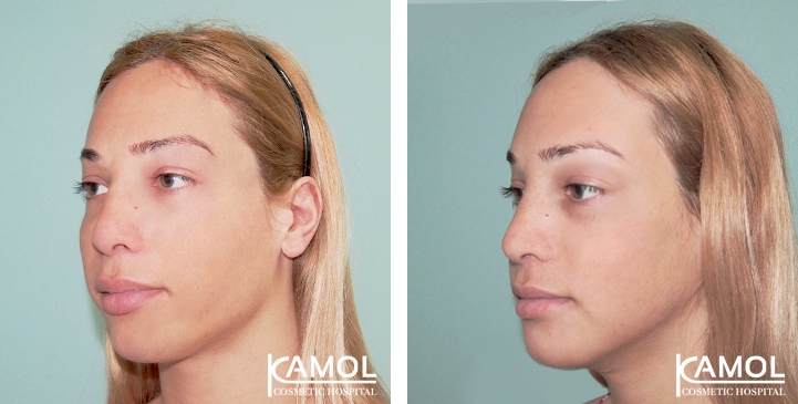 lg-649495944109d-image