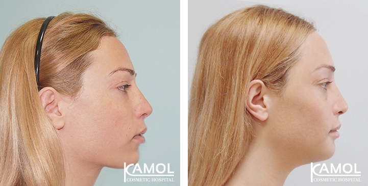 lg-649495944812a-image