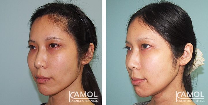 lg-6494959454d11-image