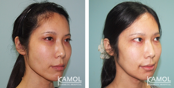 lg-6494959458eeb-image