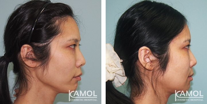 lg-649495945ae4b-image