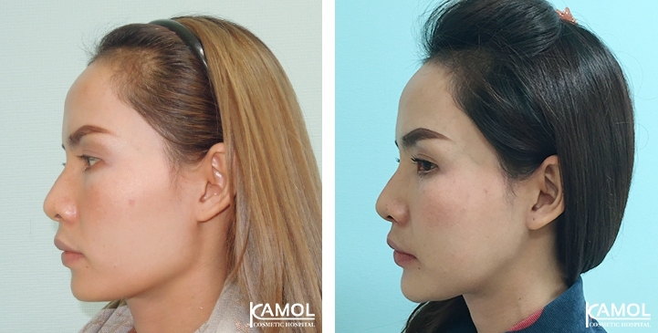 lg-6494959468280-image