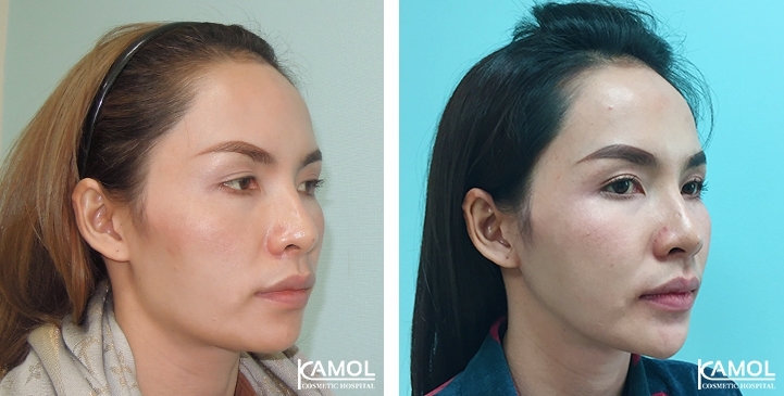 lg-649495946af5d-image