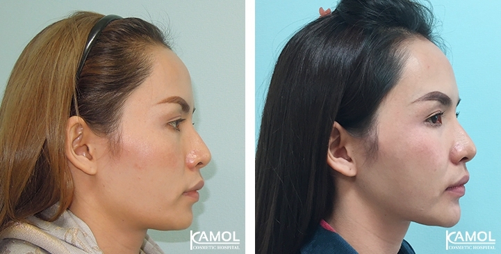 lg-649495946cf85-image