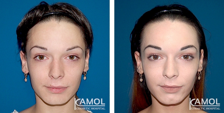 lg-6494959484b00-image