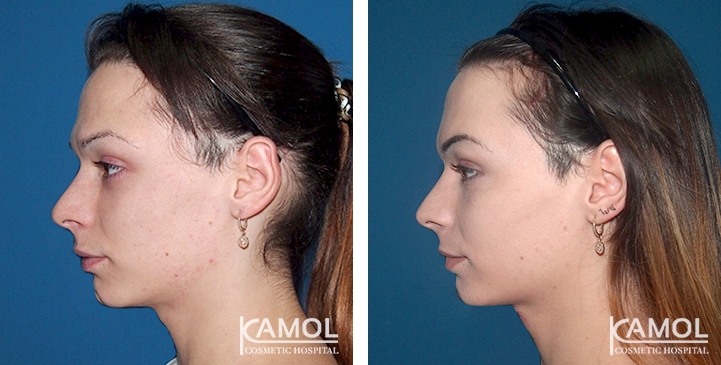 lg-6494959488c49-image