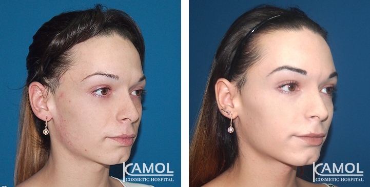 lg-649495948aba7-image