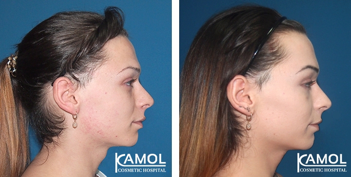 lg-649495948cc15-image