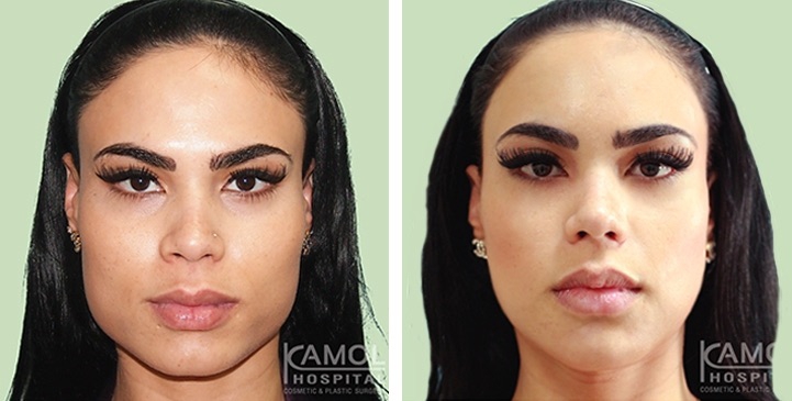 lg-6494959490186-image