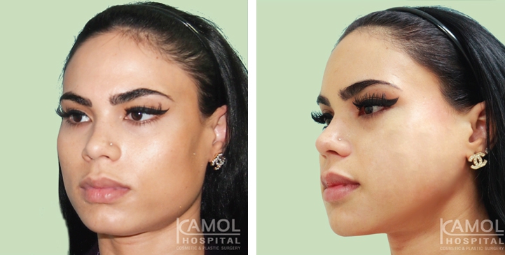 lg-6494959491dc5-image