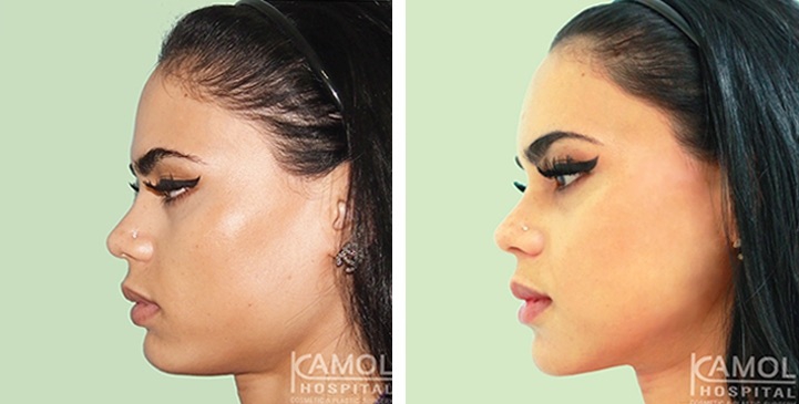 lg-6494959493551-image