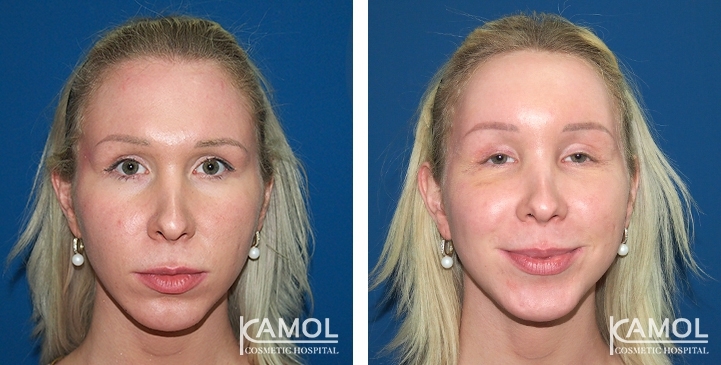 lg-6494959498cd8-image