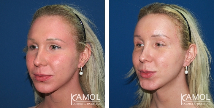 lg-649495949ac65-image