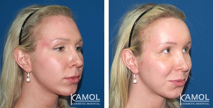 lg-649495949ec10-image