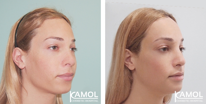 lg-64949594a77fb-image