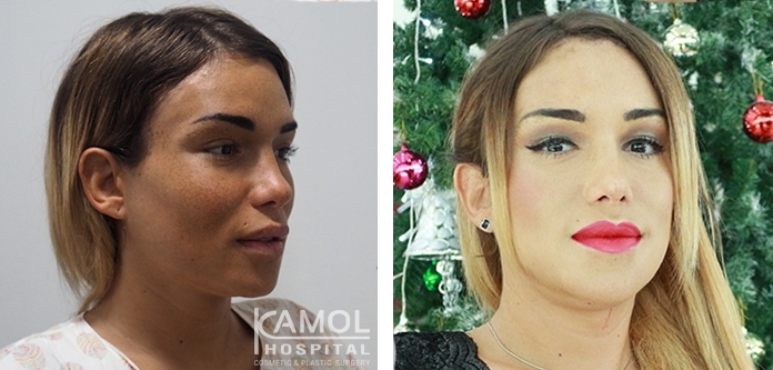 lg-64949594ad842-image