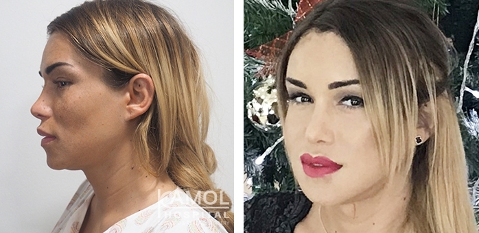 lg-64949594af8aa-image