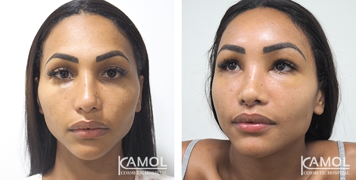 lg-64949594b23e0-image