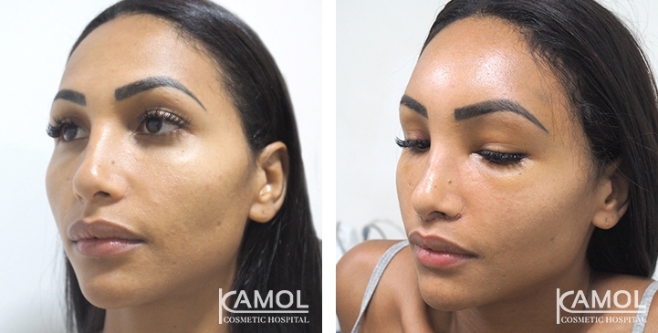 lg-64949594b440d-image