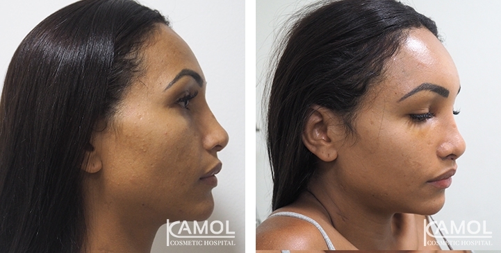 lg-64949594b9c2e-image