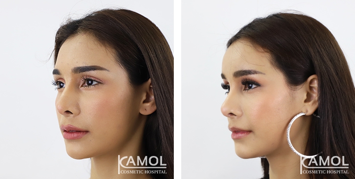 lg-64949594d7c0f-image