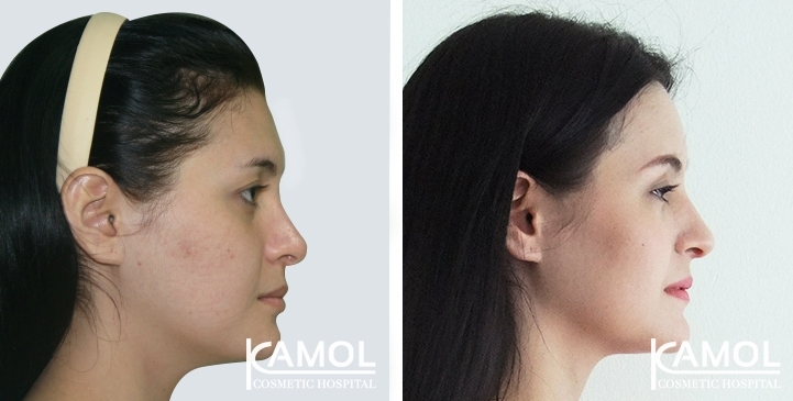 lg-64949594dfe80-image