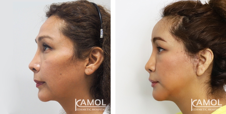 lg-64949594e6fd7-image