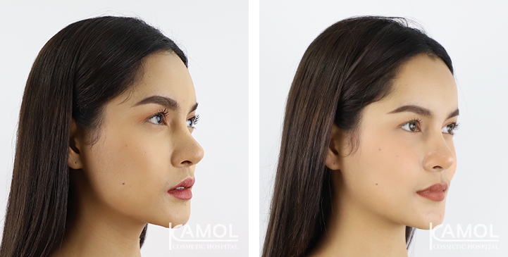 lg-64949594ee2ea-image