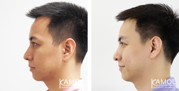 lg-649495956c382-image