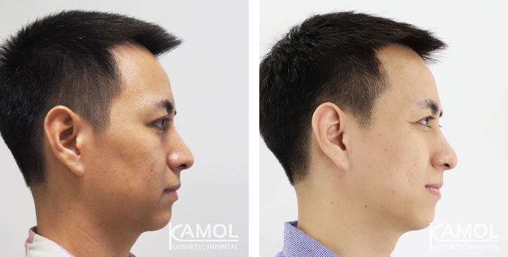 lg-6494959570a59-image