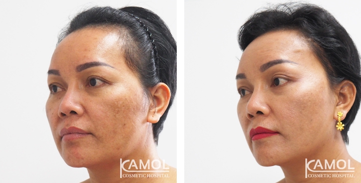 lg-6494959575dad-image