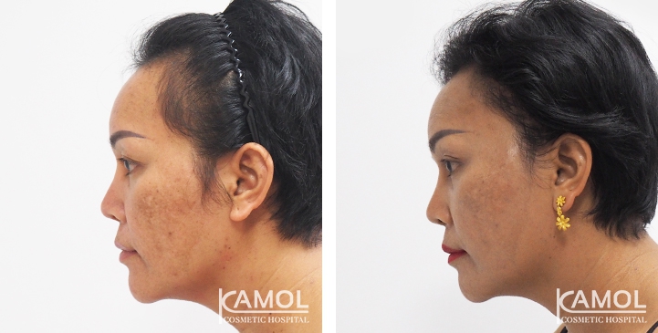 lg-6494959577d28-image